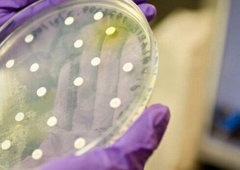 cultivo bacteriano para o diagnóstico de prostatite